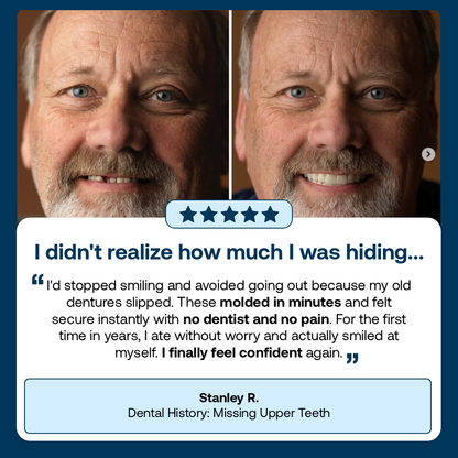 Lab-Quality Self-Fitting Full Dentures