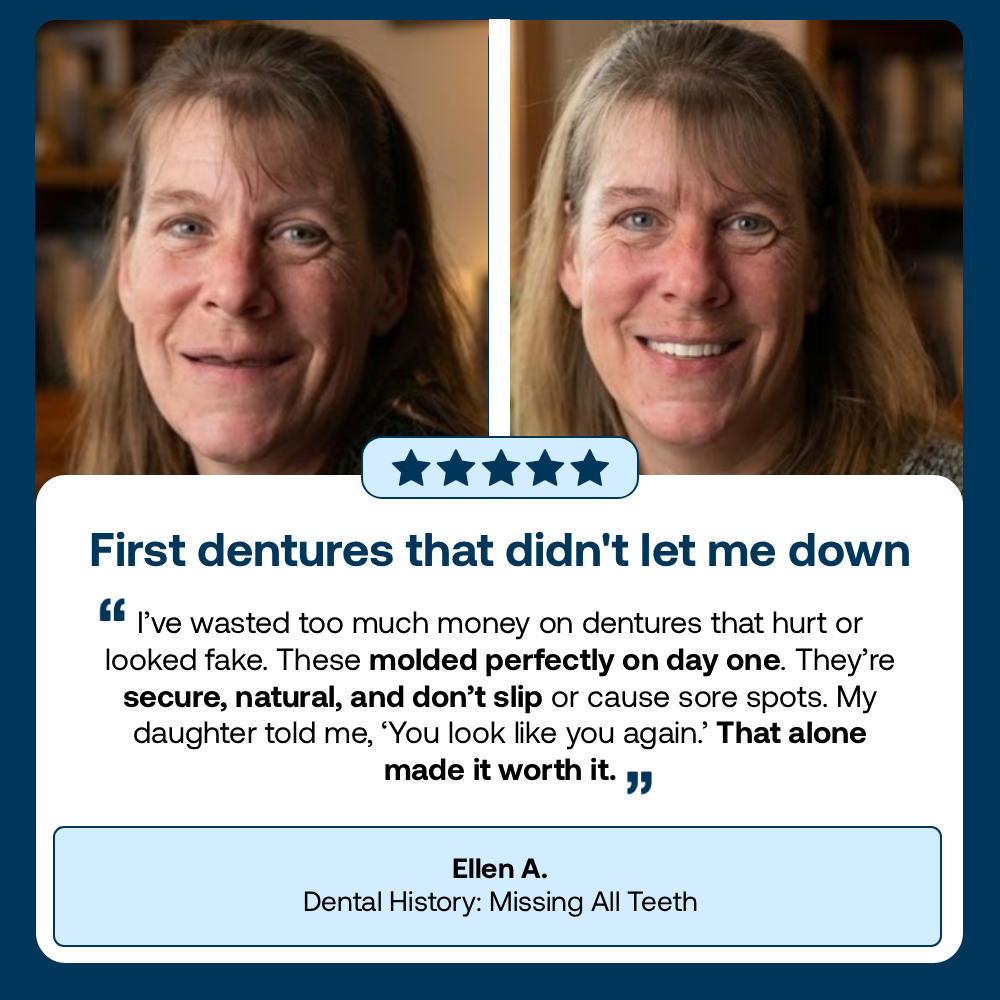 Lab-Quality Self-Fitting Full Dentures