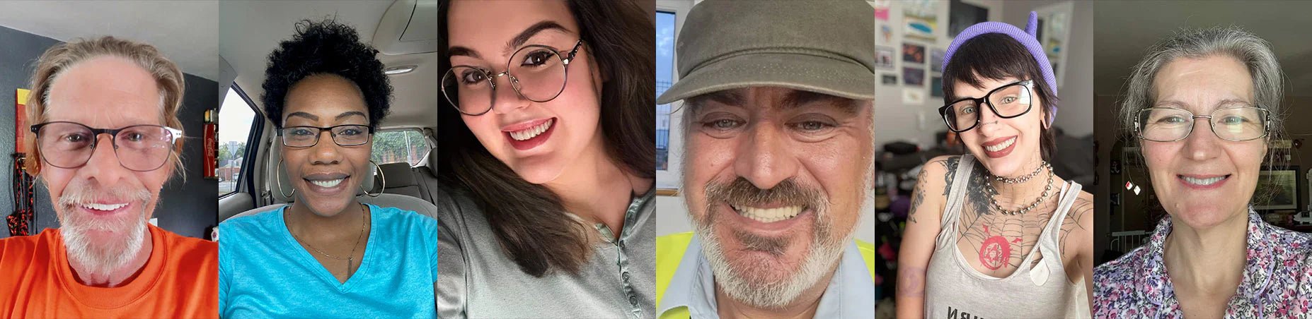 TrueEase™ Custom-Fit Full Functional Dentures – Phorm