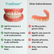 TrueEase™ Custom-Fit Full Functional Dentures – Phorm