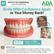 TrueEase™ Custom-Fit Full Functional Dentures – Phorm