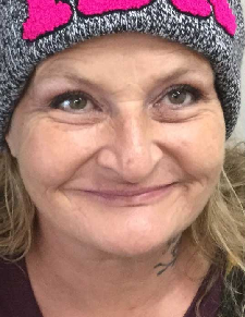 Before image for Deborah Walker